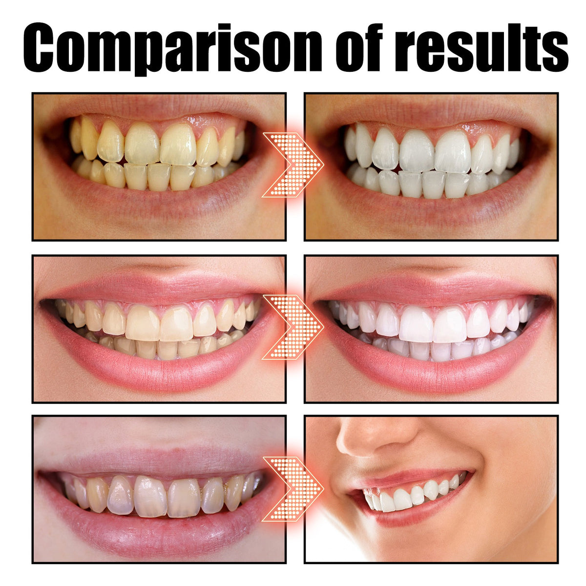 EELHOE   Oral Coconut Oil Mouthwash Removes Stains Beautifies Teeth Freshens Breath Cleans Mouth And Protects Gums