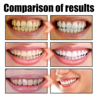 EELHOE   Oral Coconut Oil Mouthwash Removes Stains Beautifies Teeth Freshens Breath Cleans Mouth And Protects Gums